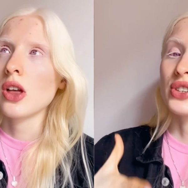 Modelo con albinismo responde preguntas frecuentes en un video viral que educa y genera empatía
