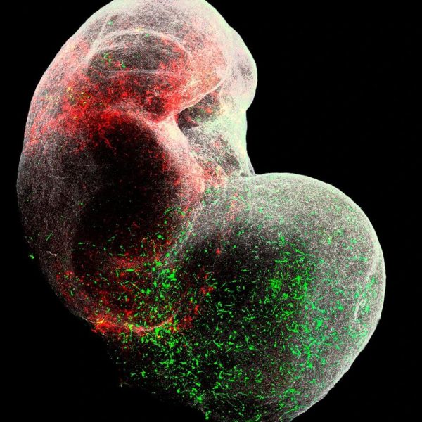 Organoides cerebrales: ¿Qué secretos del neurodesarrollo revelan?